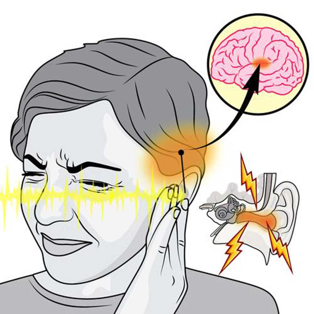 tinnitus Why Do My Ears Make Noise