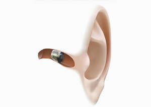 Invisible Hearing Aids