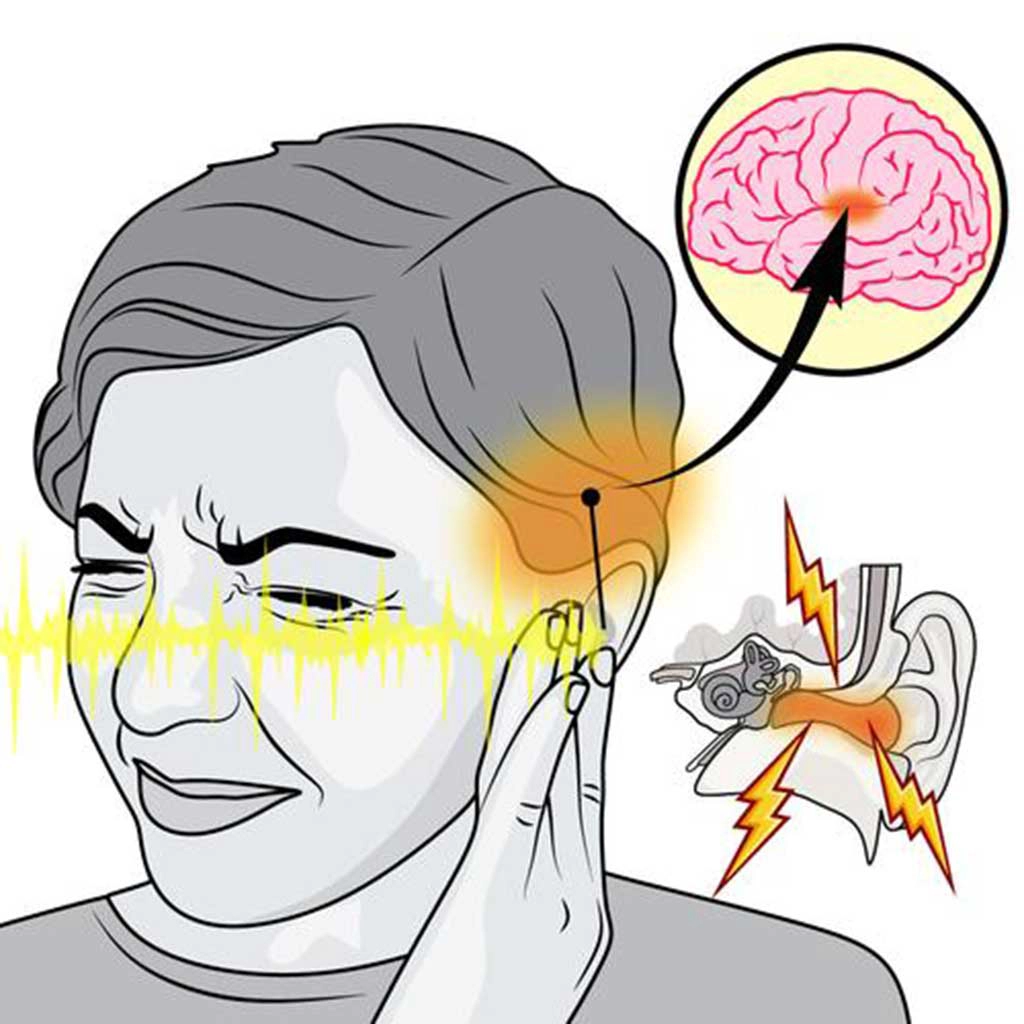 traumatic event tinnitus in Oahu HI